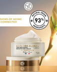 Regenerating Anti-Global Set